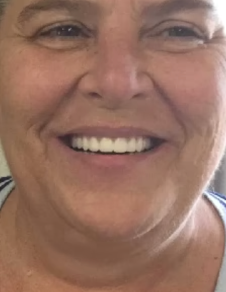 After image for Melissa Turner