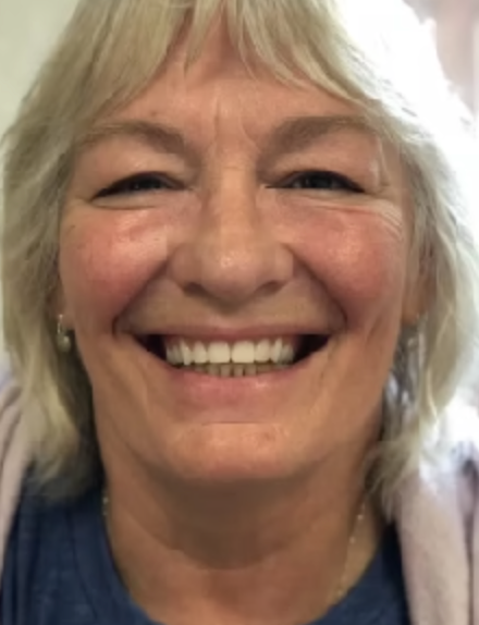 After image for Cynthia Murphy