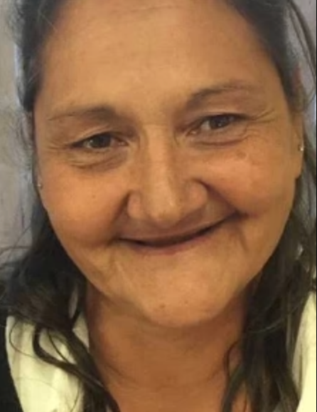 Before image for Linda Bennett