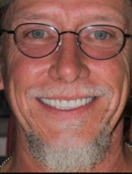 After image for Thomas Ferrer